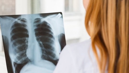 Sjednica Skupštine Udruženja “Diši za život” 11. oktobra u Banjaluci